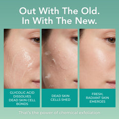 clear label close-up on PatchRx jar highlighting glycolic and salicylic concentration