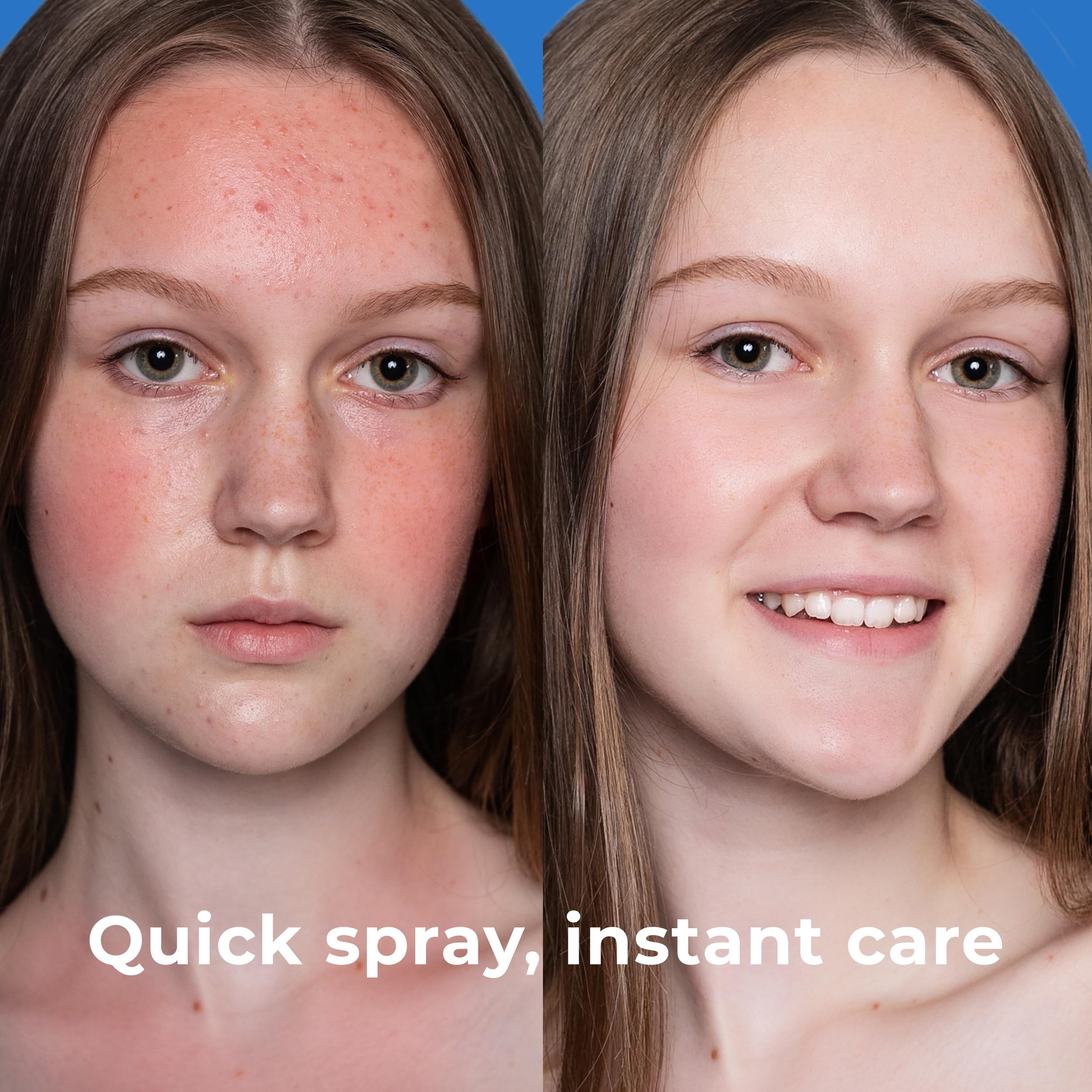 PatchRx spraying chest and back to refresh skin after exercise and reduce buildup