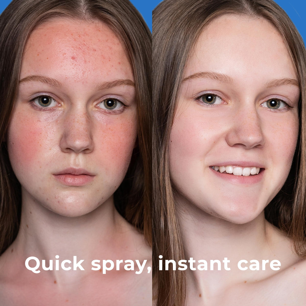 PatchRx spraying chest and back to refresh skin after exercise and reduce buildup