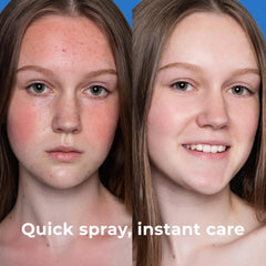 PatchRx spraying chest and back to refresh skin after exercise and reduce buildup