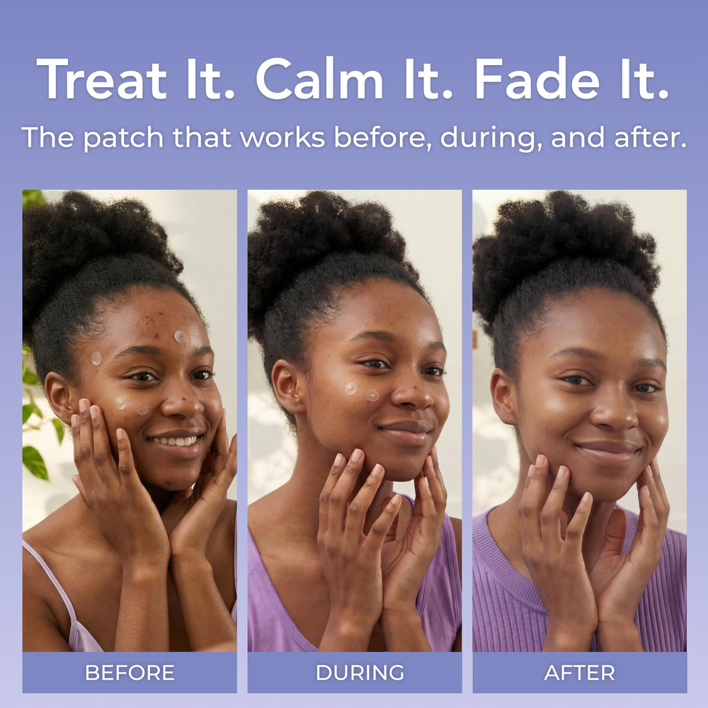 PatchRx patch under makeup demonstrating invisible coverage and confidence