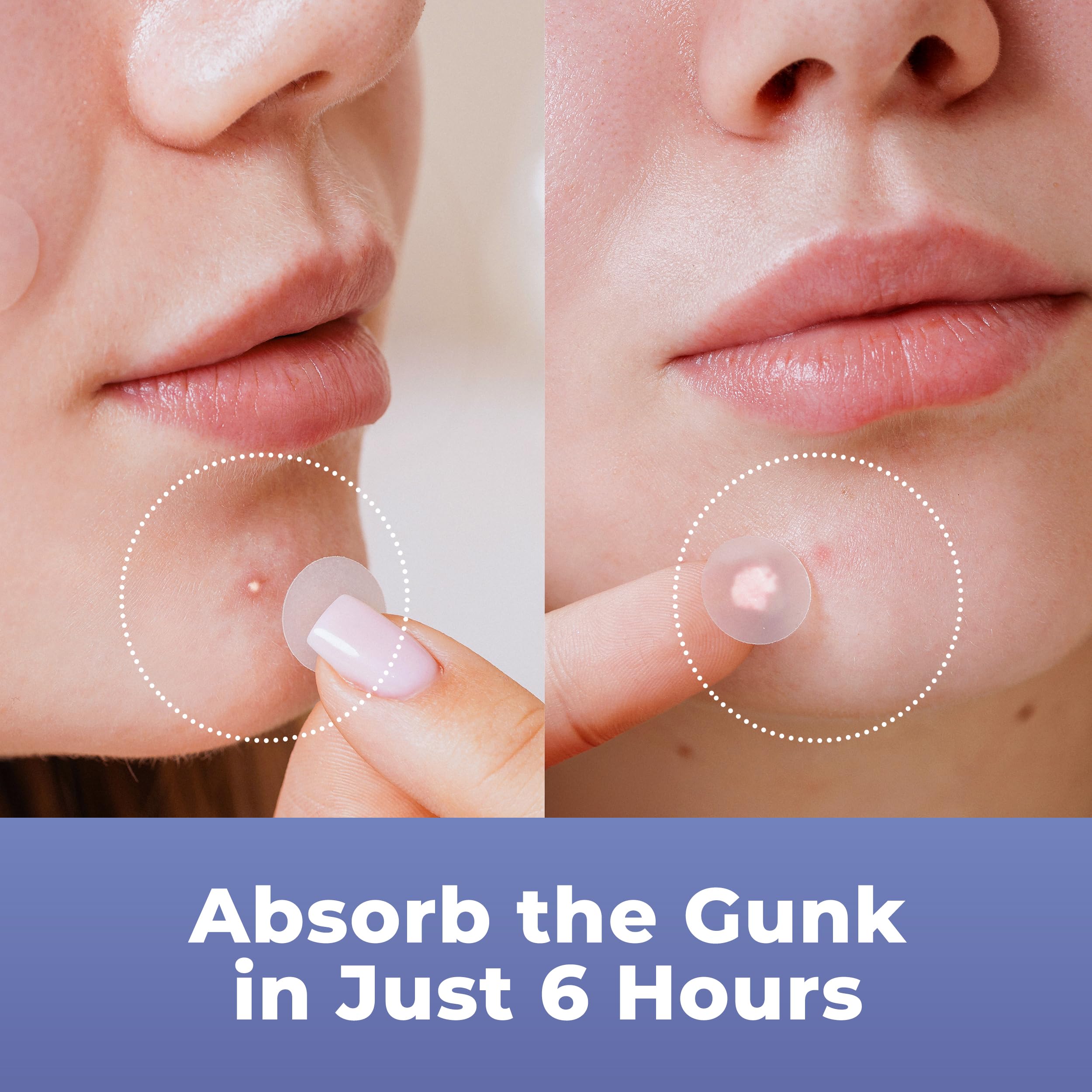 PatchRx patch under makeup demonstrating invisible wear