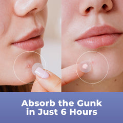 PatchRx patch under makeup demonstrating invisible wear