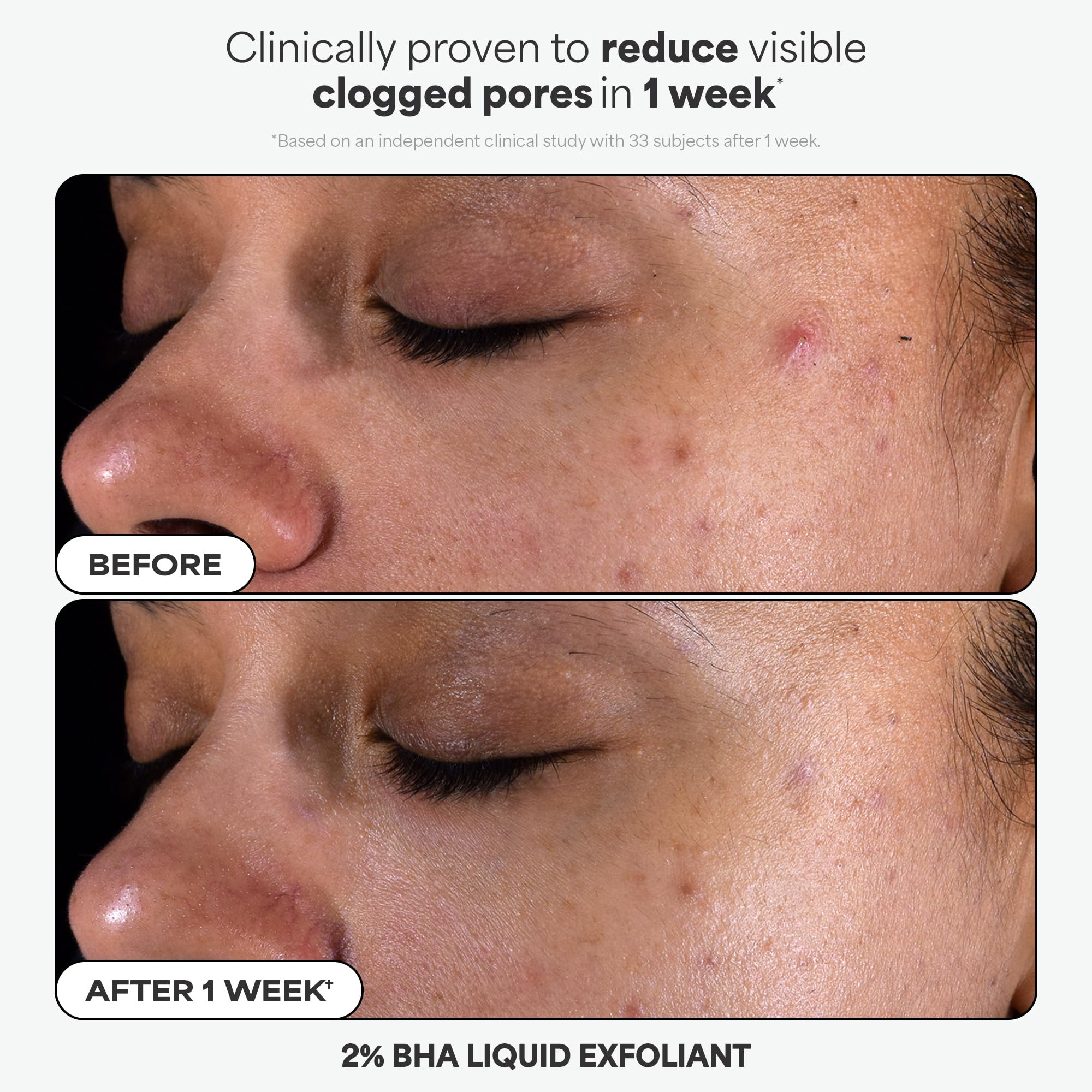 Paula's Choice 2% BHA liquid close-up texture showing lightweight serum benefit: clear pores