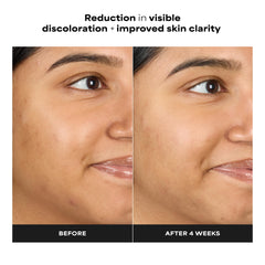 Paula's Choice bottle label detail showing key ingredient clarity