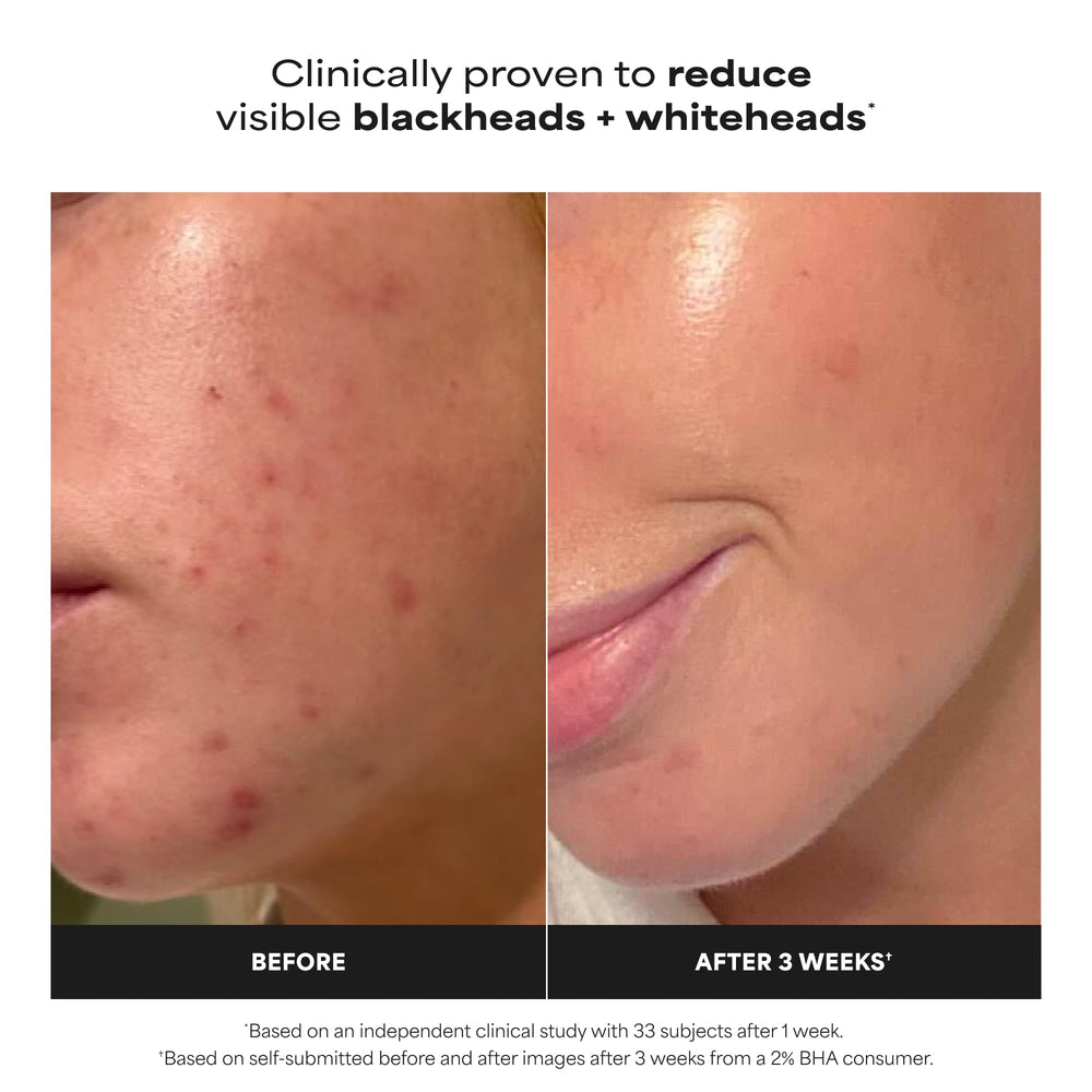Paula's Choice label close-up highlighting 2% BHA concentration for effective exfoliation