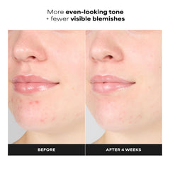 Paula's Choice gel texture close-up demonstrating lightweight hydration