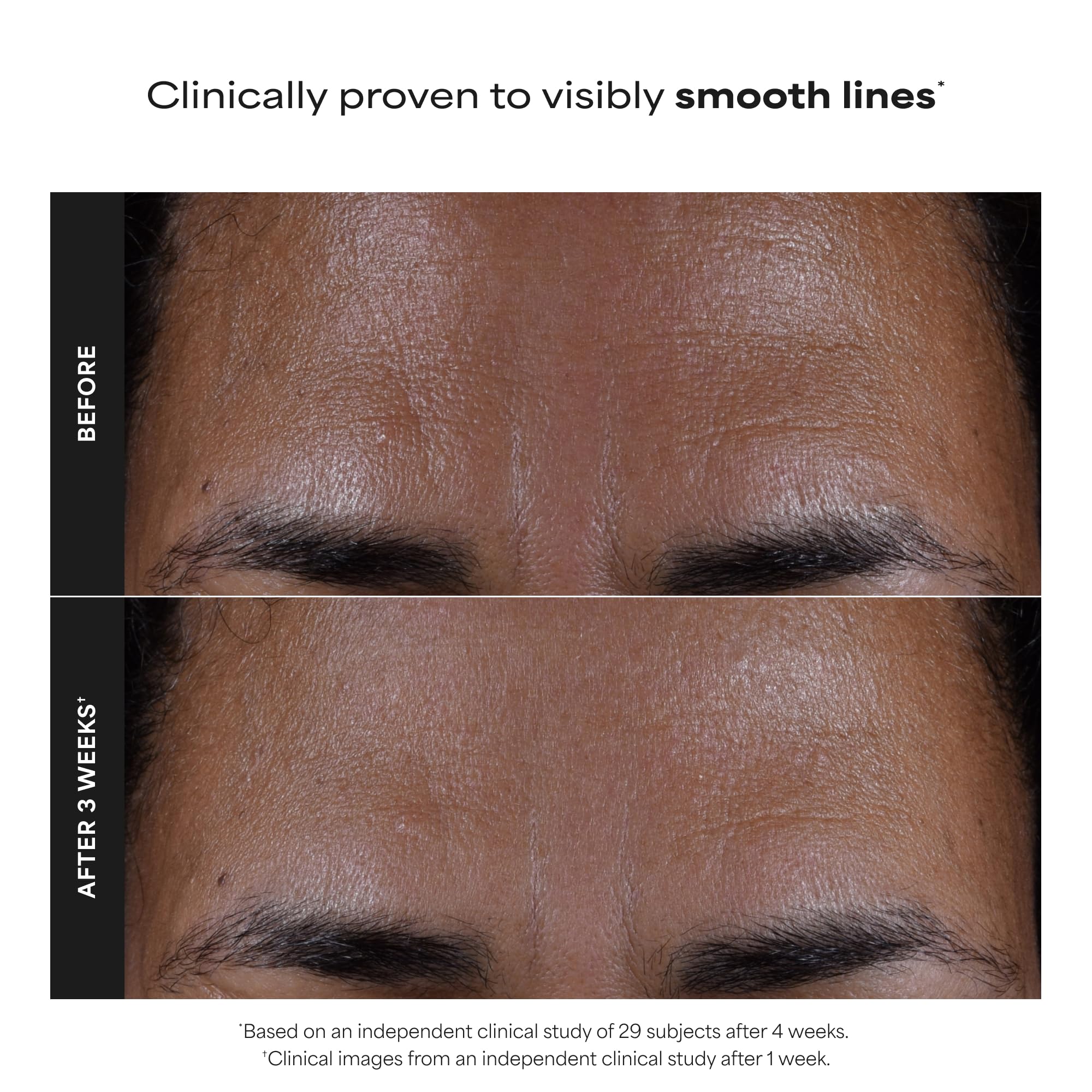 Drop of Paula's Choice liquid exfoliant on a fingertip showing lightweight texture and easy application
