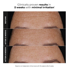 Paula's Choice serum texture drop on fingertip showing smooth spreadability