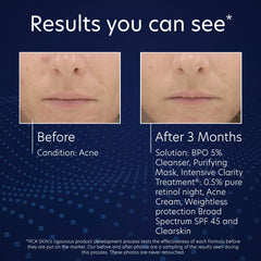 Hand holding PCA SKIN face wash demonstrating easy dispensing and controlled use