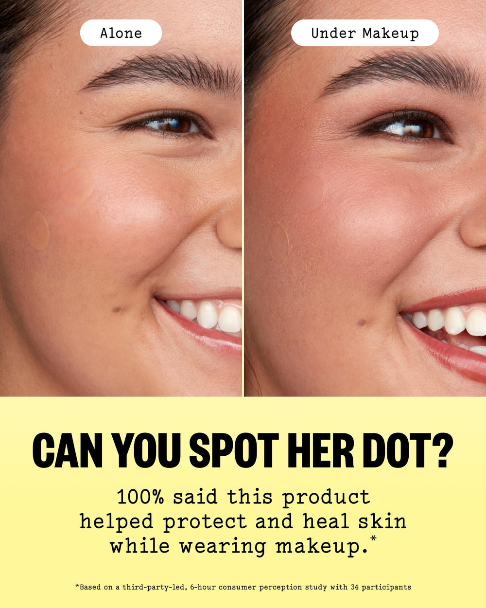 PEACE OUT ingredient icons for salicylic acid retinol and aloe vera benefits