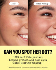 PEACE OUT ingredient icons for salicylic acid retinol and aloe vera benefits