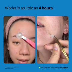 Peach Slices patch blended under makeup for discreet wear