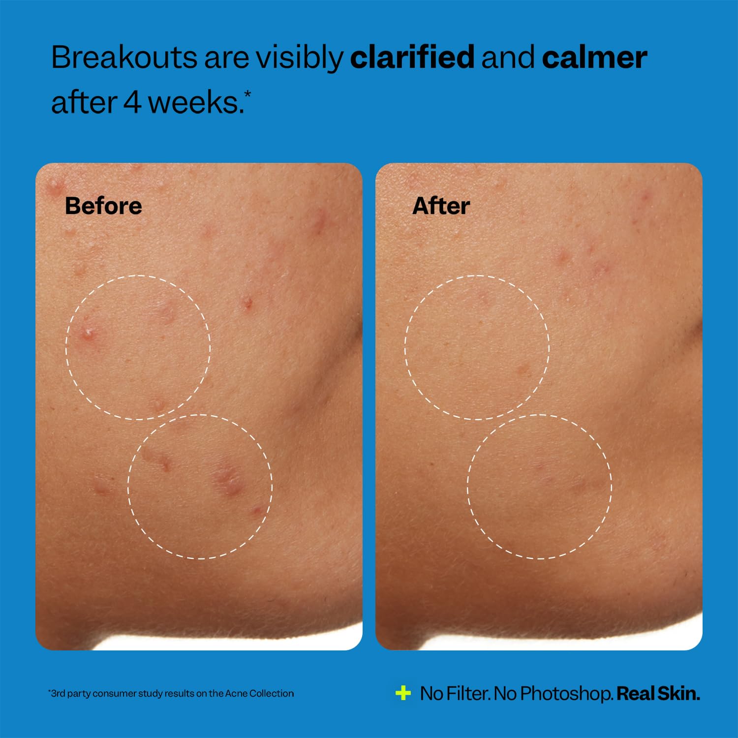 Peach Slices used at sink in morning routine to control oil and breakouts
