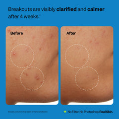 Peach Slices used at sink in morning routine to control oil and breakouts