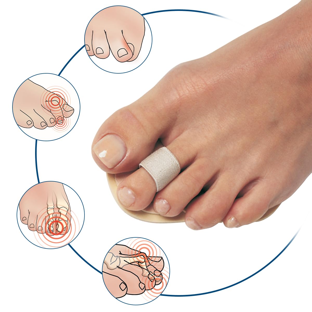 Pedifix Budin close-up of toe loop illustrating gentle toe separation benefit