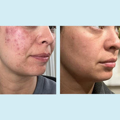 Perfect Image ingredient label highlighting glycolic, retinyl palmitate and botanicals