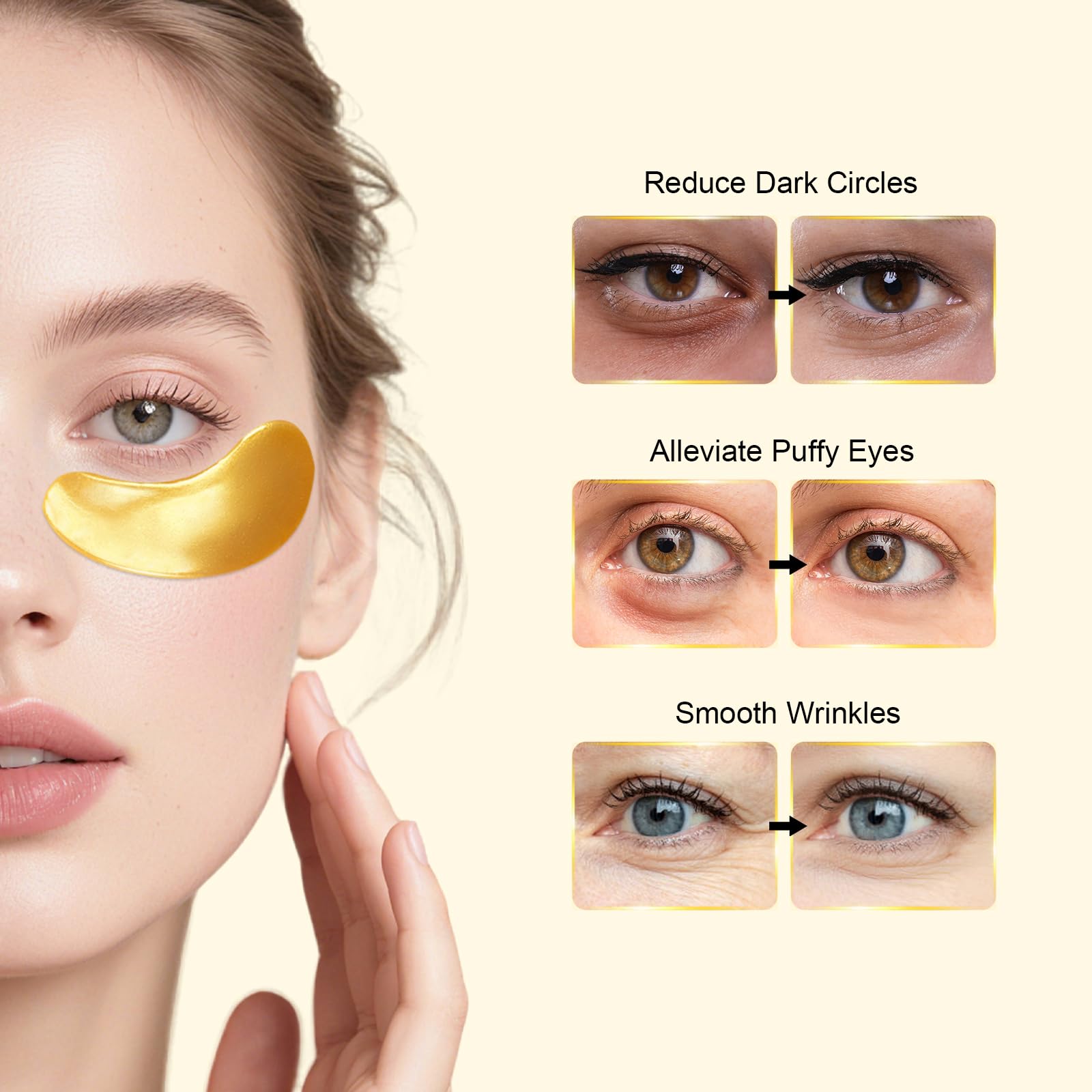 Permotary after treatment showing smoother hydrated under-eye skin
