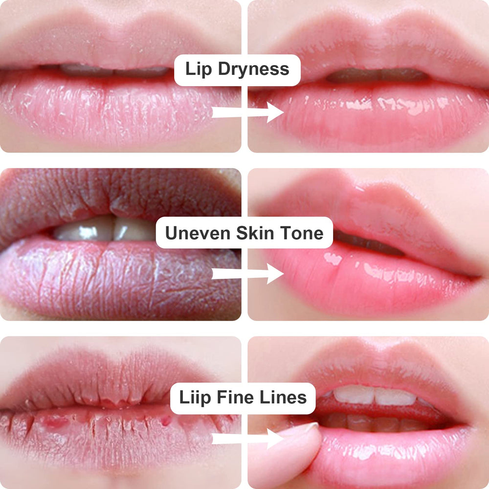 Permotary gel pad applied on lips demonstrating immediate smoothing effect