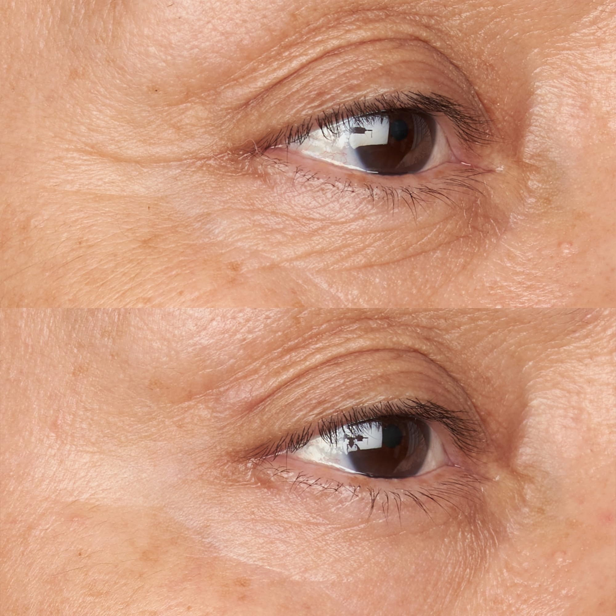 Perricone MD eye cream texture closeup displaying smooth hydrating finish
