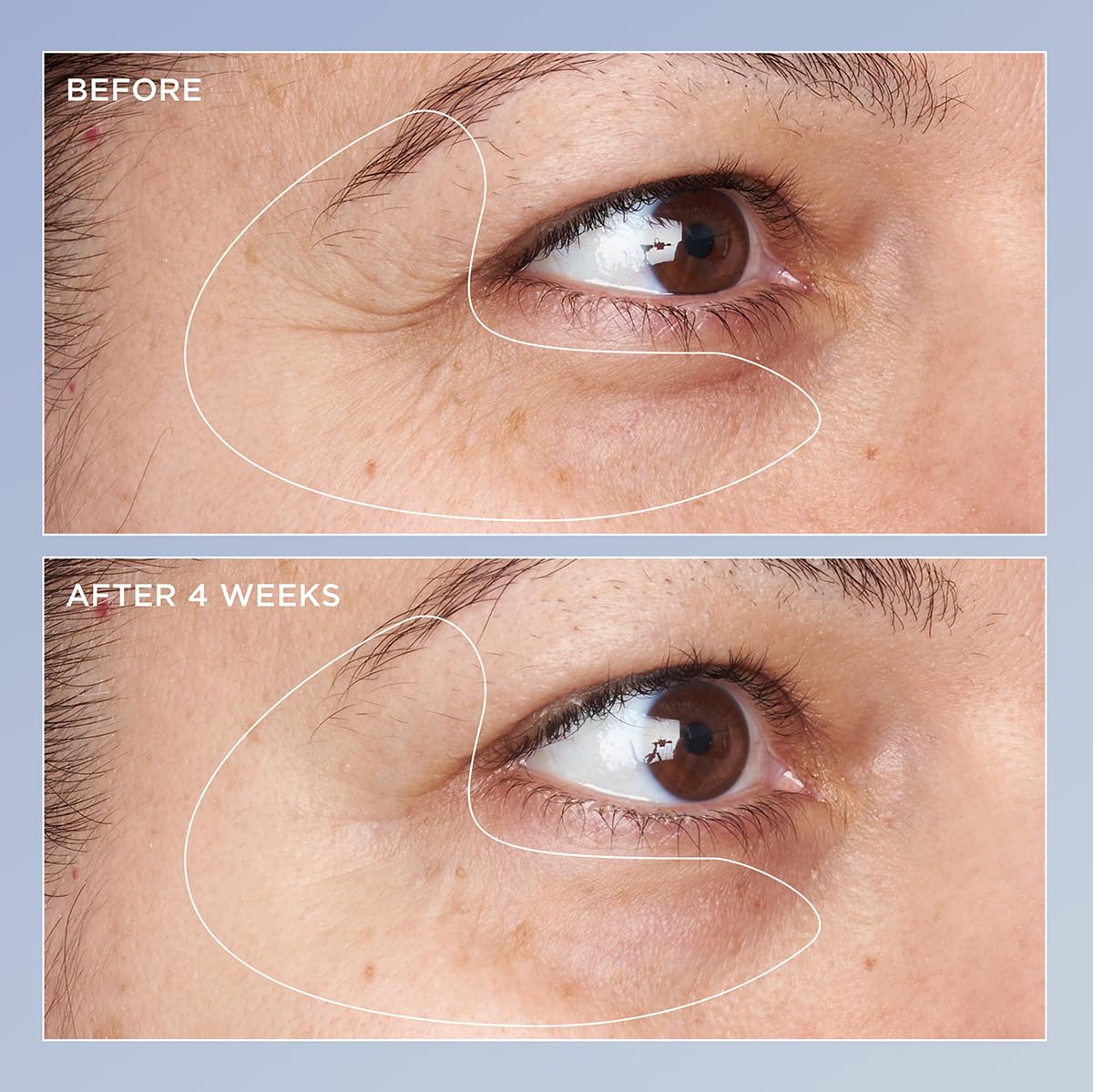 Perricone MD applying serum under eye on model demonstrating visible brightening benefit