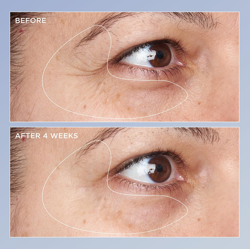 Perricone MD applying serum under eye on model demonstrating visible brightening benefit