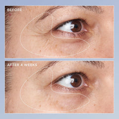 Perricone MD applying serum under eye on model demonstrating visible brightening benefit