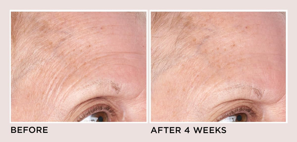 Perricone MD next to Vitamin E bottle highlighting antioxidant hydration