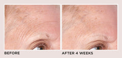 Perricone MD next to Vitamin E bottle highlighting antioxidant hydration