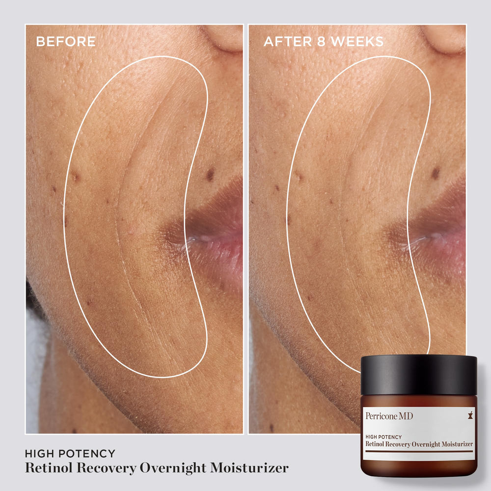 Perricone MD open jar top view showing cream appearance and easy scoop application