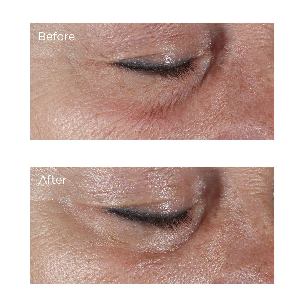 Perricone MD jar beside common item showing compact travel-friendly benefit