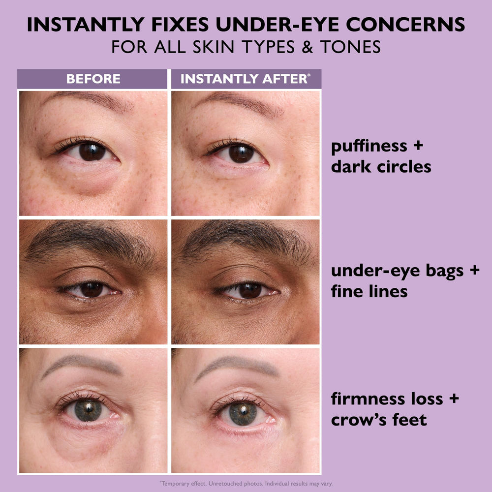 Peter Thomas Roth before and after comparison illustrating reduced lines and puffiness
