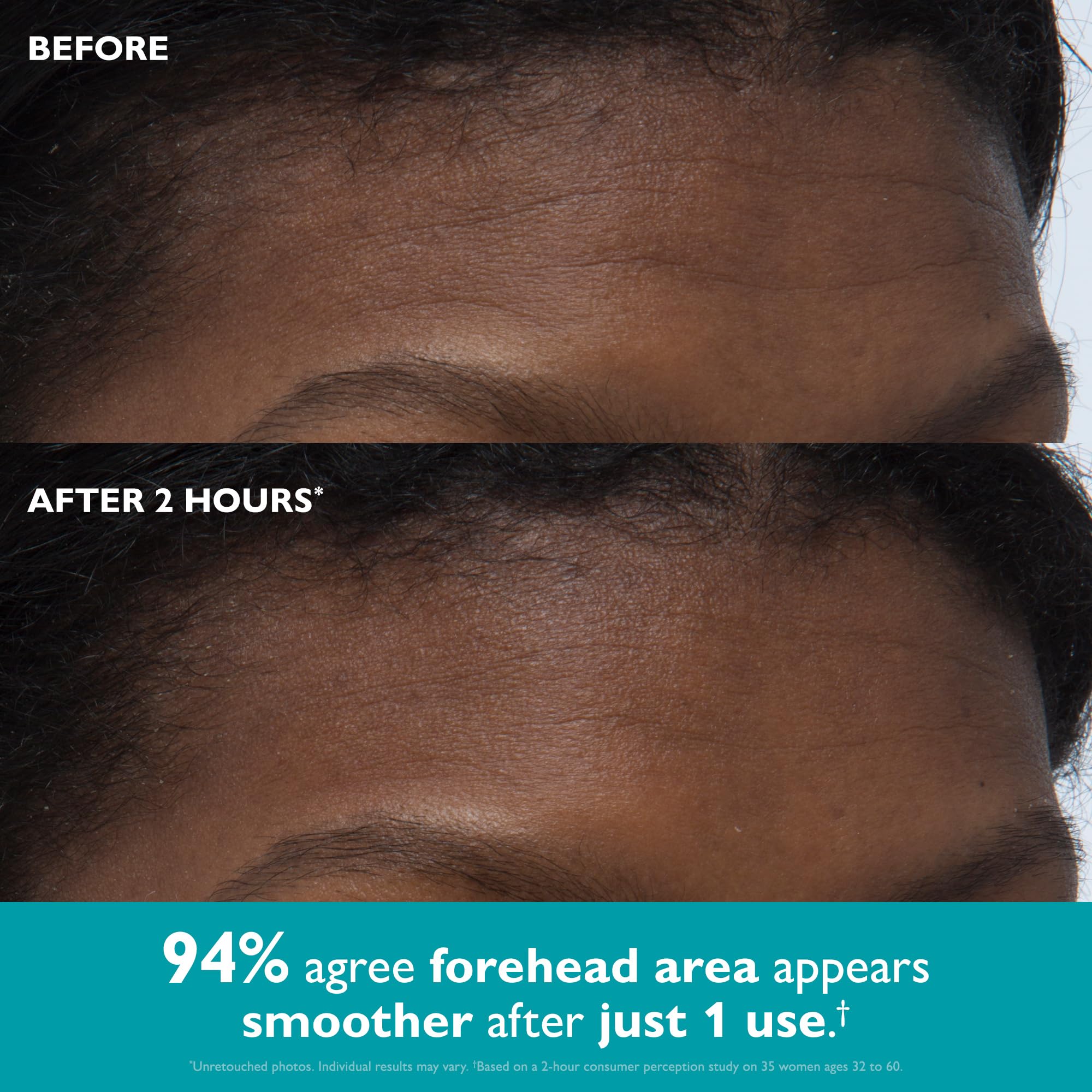 Peter Thomas Roth oval tape applied to forehead demonstrating smoothing
