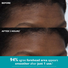 Peter Thomas Roth oval tape applied to forehead demonstrating smoothing