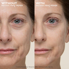 Peter Thomas Roth product tube close-up highlighting applicator tip