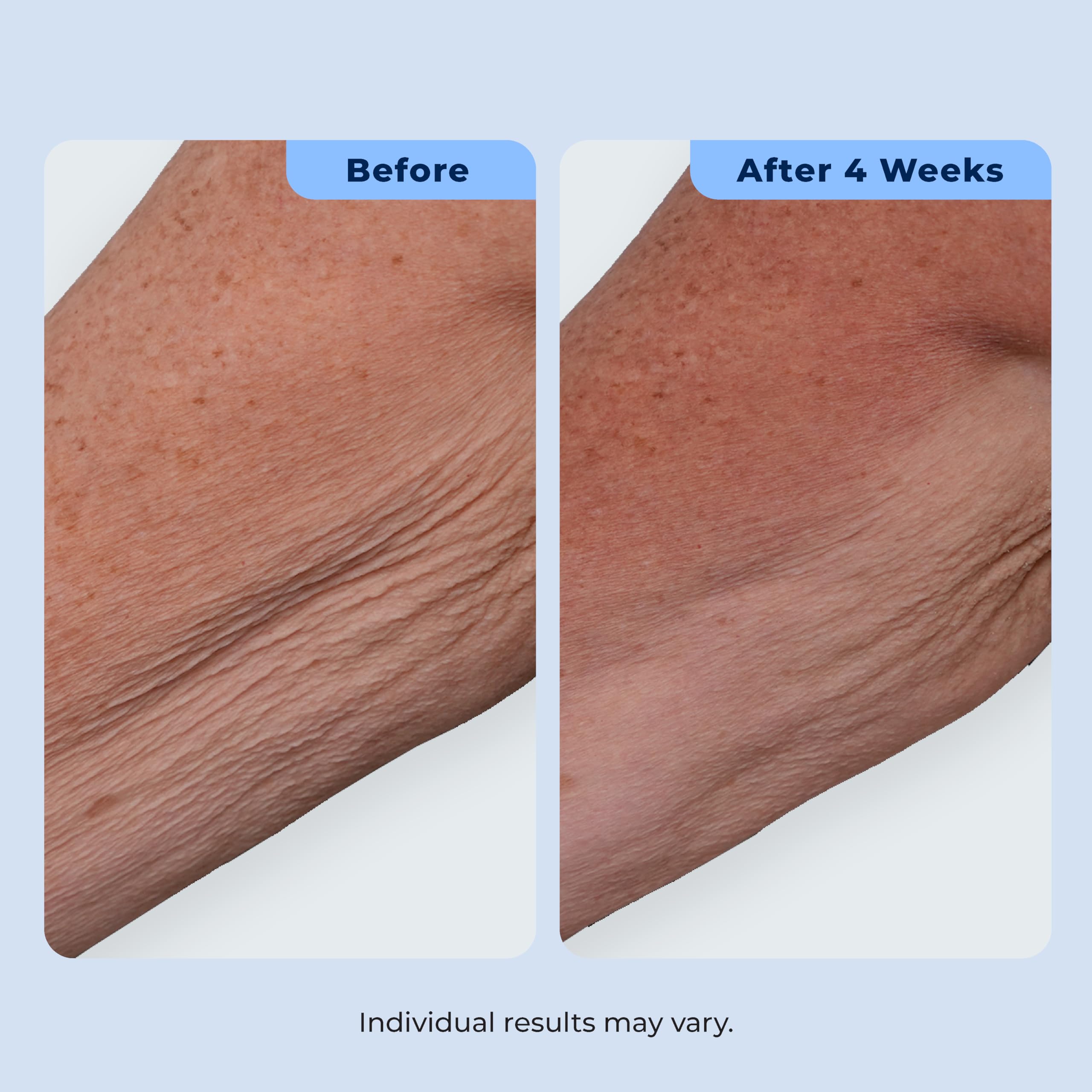 Plexaderm jar open showing creamy formula and ingredient clarity for confidence