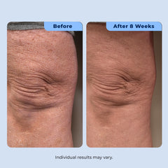 Plexaderm label ingredient callout emphasizing retinol, bakuchiol, and hyaluronic benefits