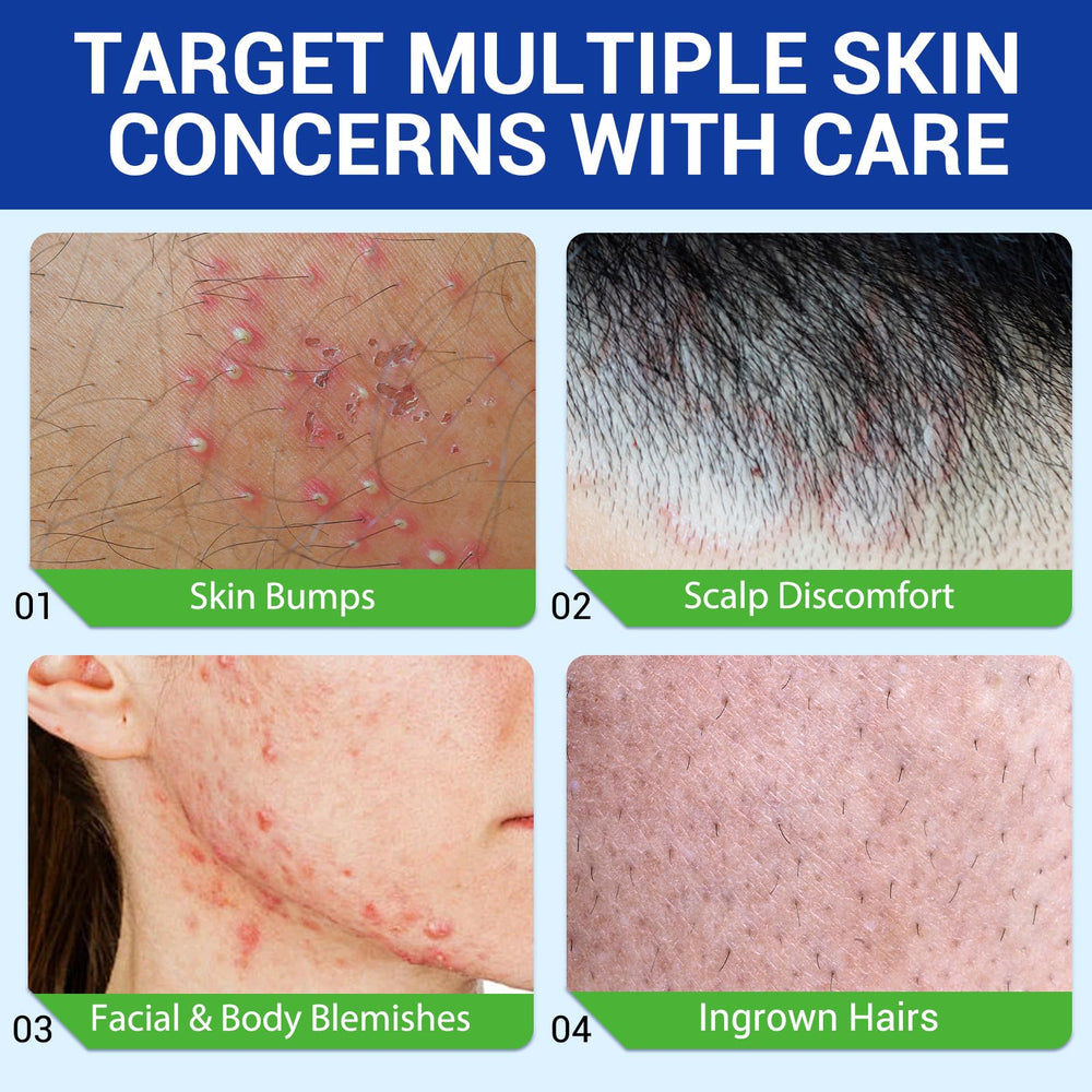 plomala size and scale with hand displaying 120g tube convenience for multi-area use