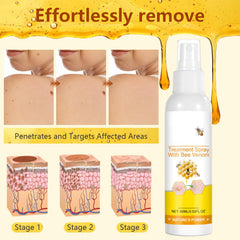 Plresen bee venom spray bottle next to hand showing portable travel-friendly size