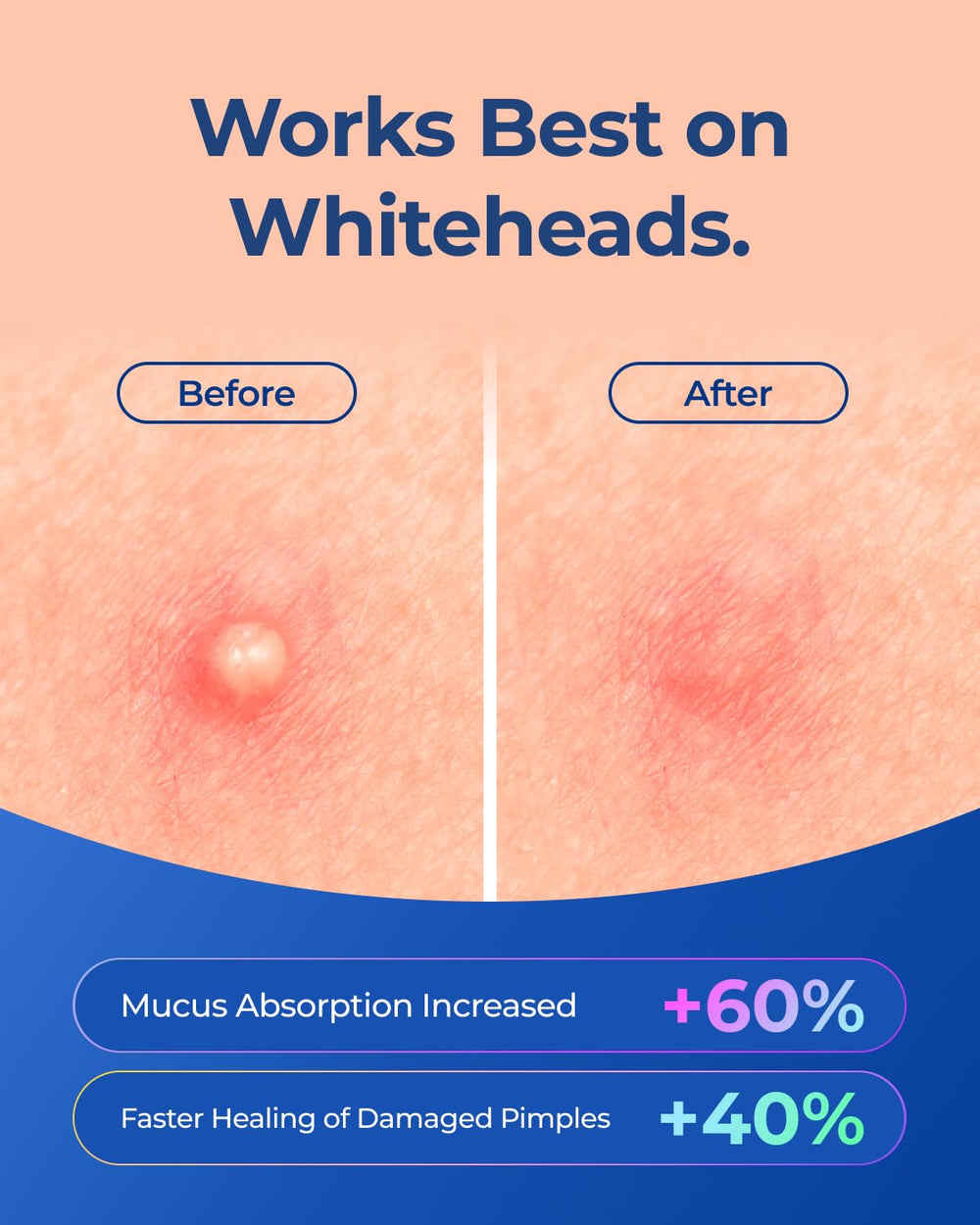 POINTMASS patch applied on cheek demonstrating secure wear and discreet protection