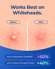 POINTMASS patch applied on cheek demonstrating secure wear and discreet protection