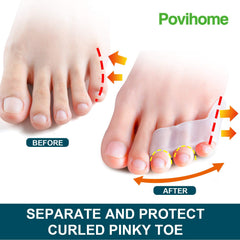Povihome three-hole fit detail showing secure hold for little toe