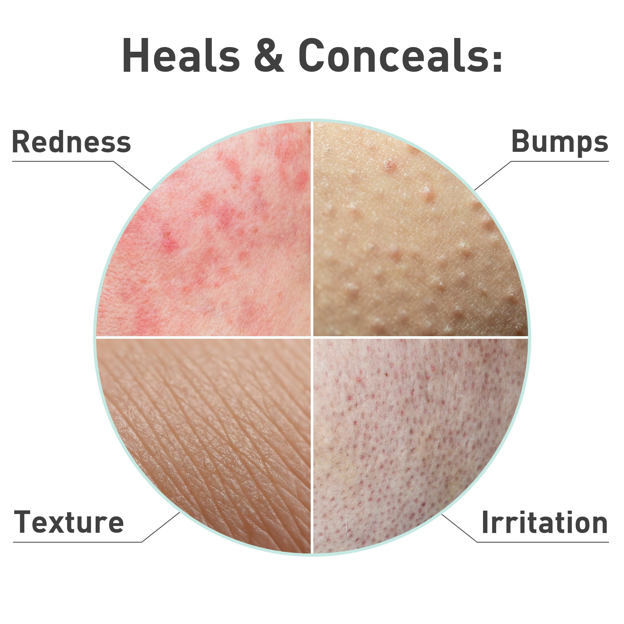 PROcure model wearing mask mid-treatment showing calming fit and instant cooling effect for redness