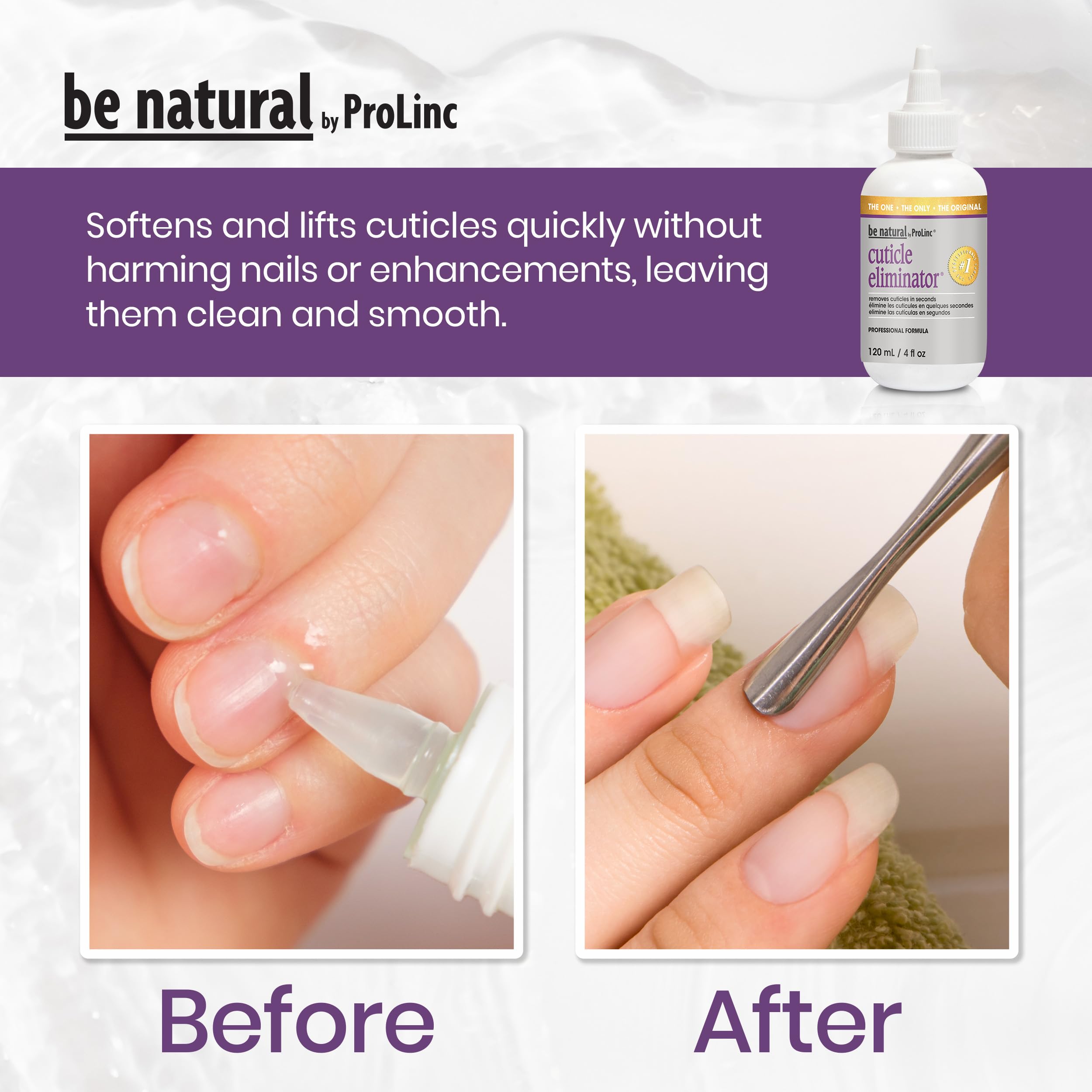 ProLinc before and after nails showing cleaner, smoother cuticle area