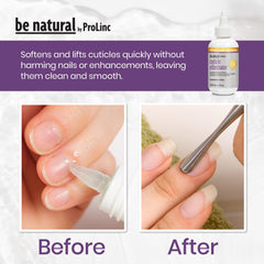 ProLinc before and after nails showing cleaner, smoother cuticle area