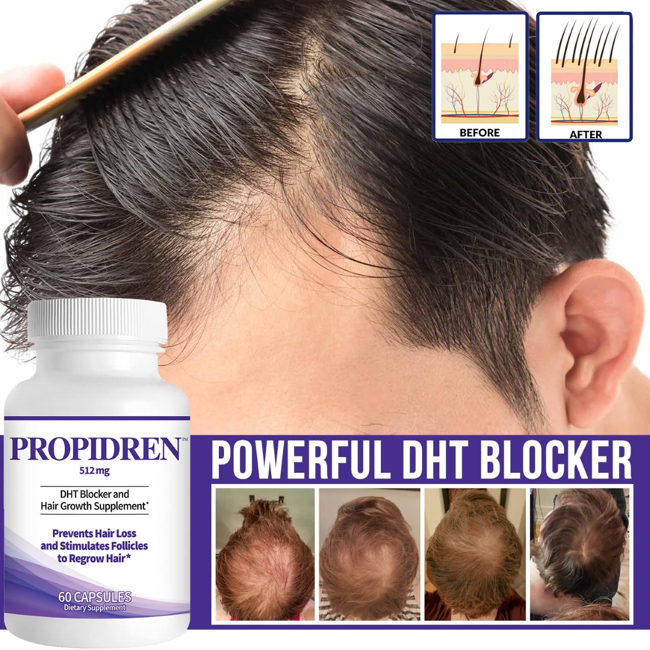 Pronexa Propidren ingredient label clear view to verify botanicals and dosages