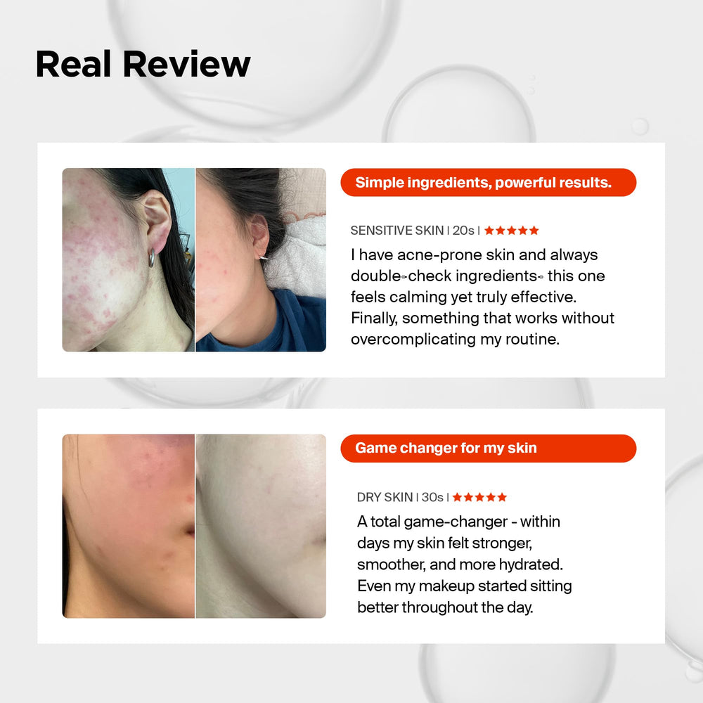 PURCELL Pixcell before after skin texture comparison illustrating refined pores and improved resilience