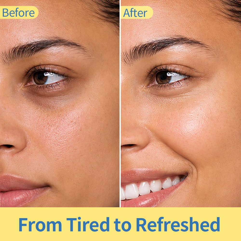 Purederm being applied under eye demonstrating de-puffing massage and immediate cooling