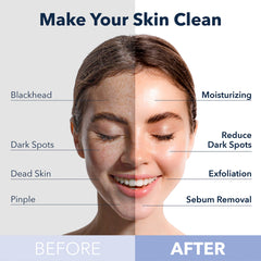 Purederm mask with oxygen bubbles activating for deep cleanse