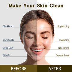 Purederm serum texture on pipette showing concentrated vitamin C boost